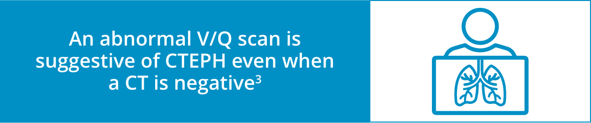 Abnormal V/Q Scan