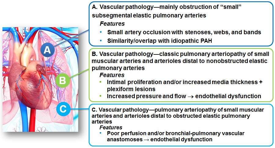 vascular pathology graphic