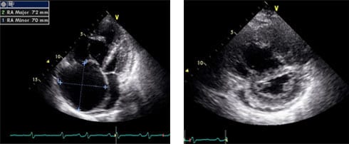 echocardiogram image