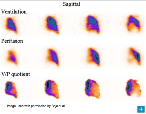 heart failure scan image heart failure scan image