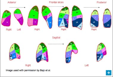 lung anatomy graphic lung anatomy graphic