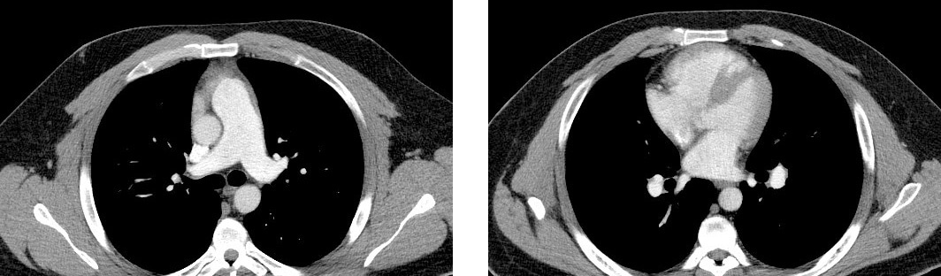CT scan image CT scan image