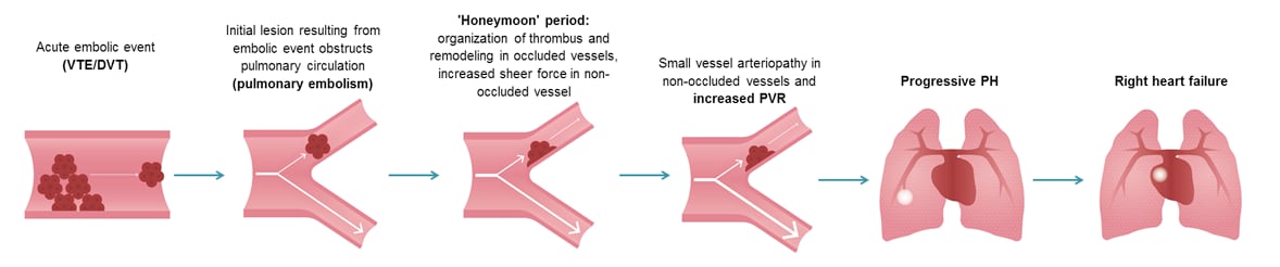 Thromboembolic model of CTEPH progression