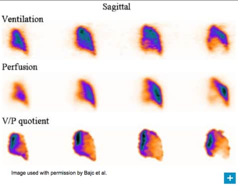 heart failure scan image