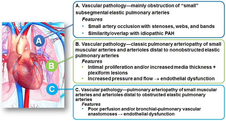 vascular pathology graphic vascular pathology graphic